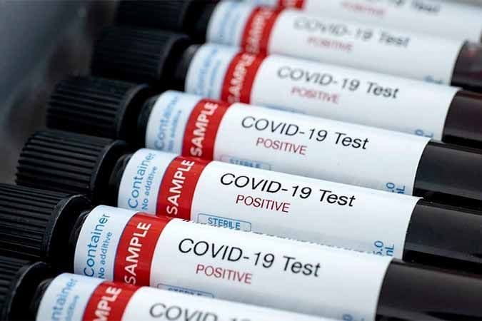La Provincia inicia test de vigilancia en 14 hospitales